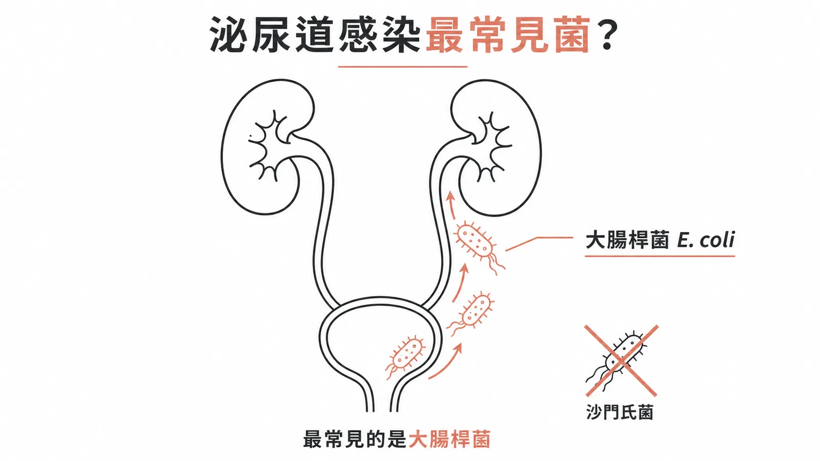 泌尿道感染最常見菌是大腸桿菌而非沙門氏菌