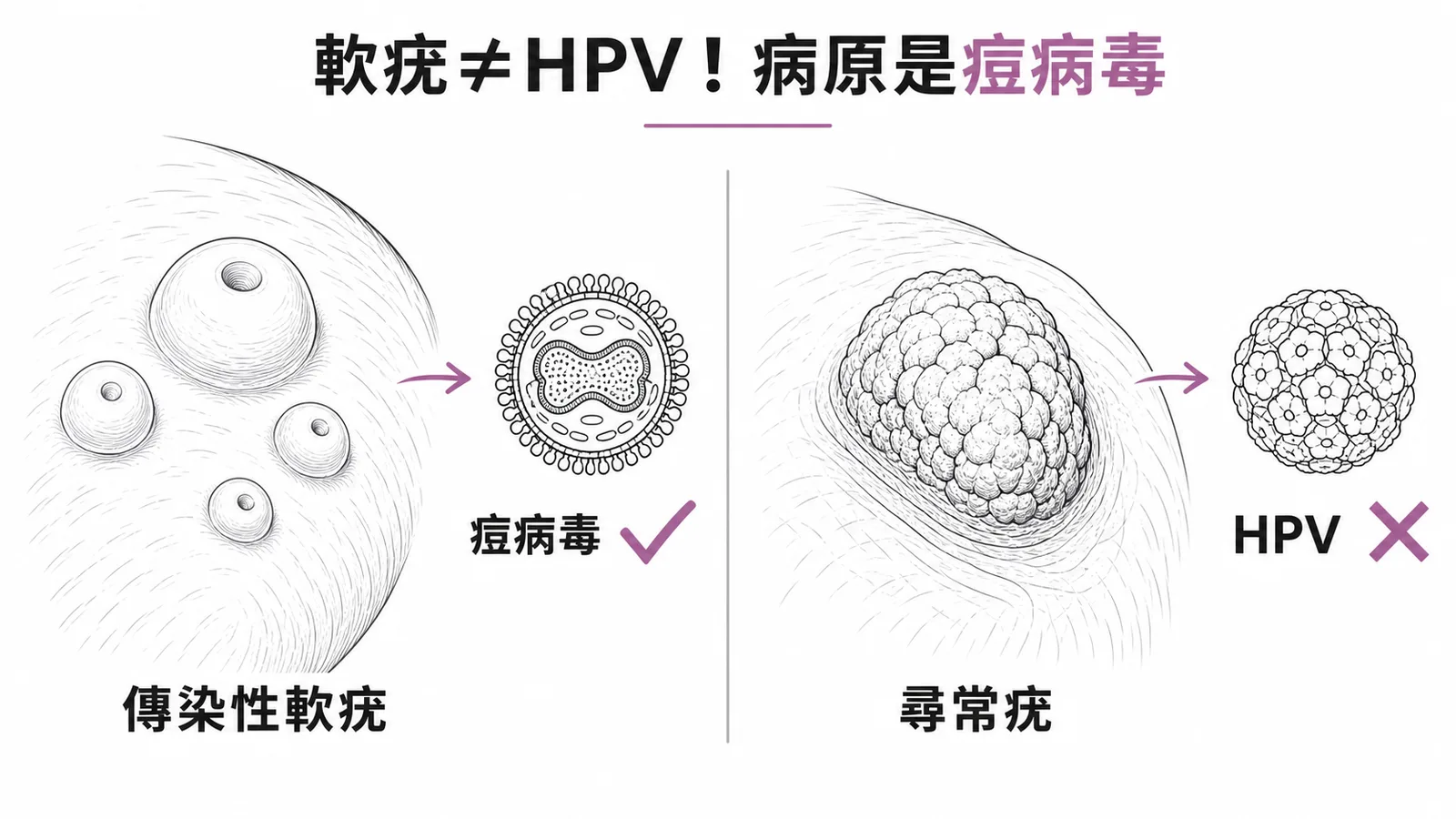 傳染性軟疣病原是痘病毒科,非HPV