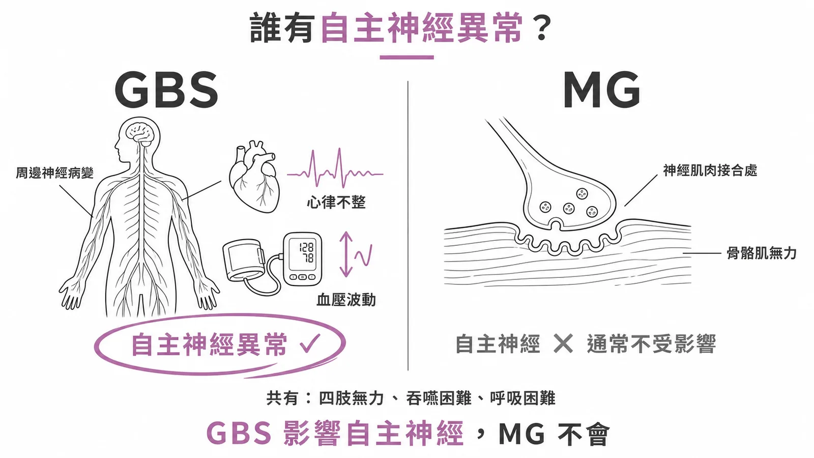 GBS與MG鑑別:GBS有自主神經異常而MG通常不會