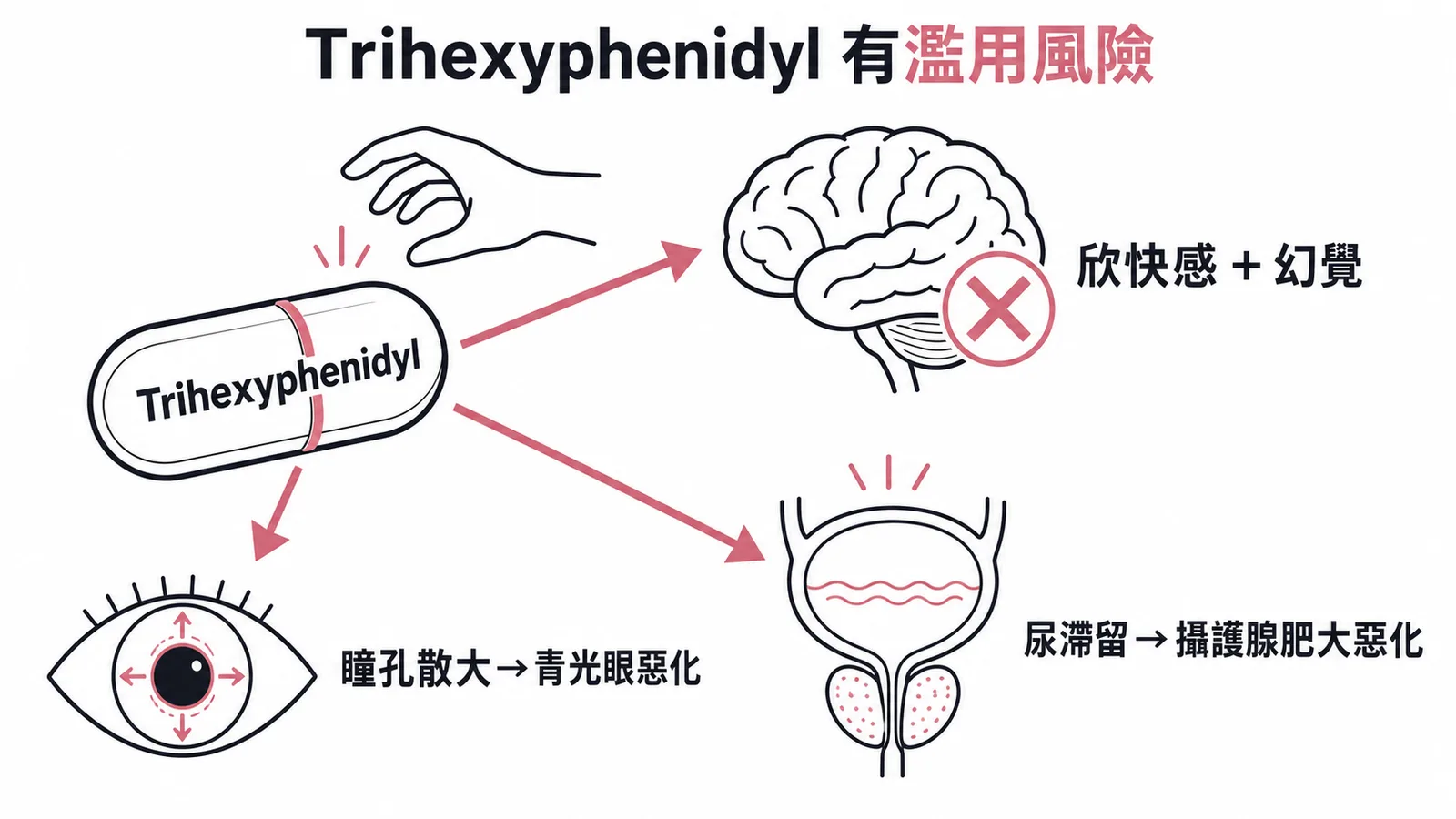 Trihexyphenidyl三大副作用:濫用風險、青光眼惡化、攝護腺肥大惡化