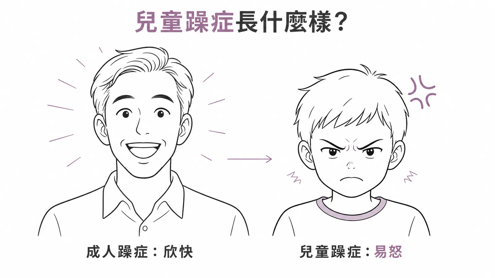 兒童躁症表現為易怒而非成人典型的欣快