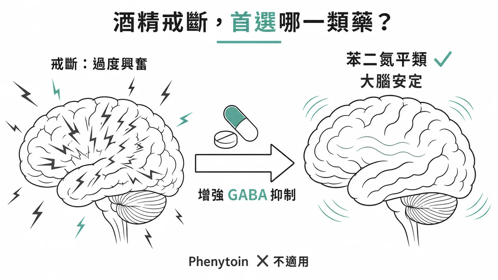 酒精戒斷首選苯二氮平類藥物增強GABA抑制