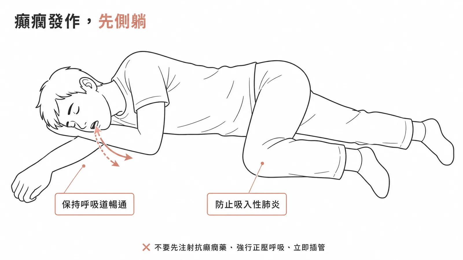 癲癇發作首要讓病人側躺維持呼吸道暢通