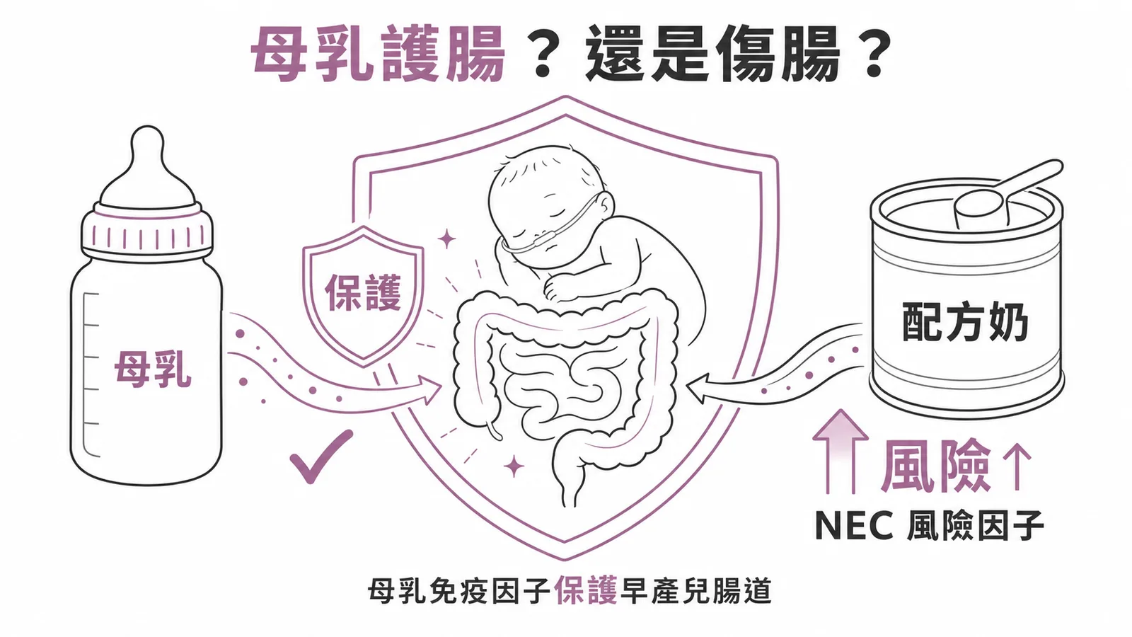 NEC壞死性腸炎：母乳保護早產兒腸道而配方奶為風險因子