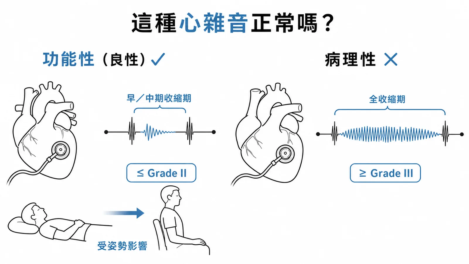 功能性與病理性心雜音對照：強度與收縮期範圍差異
