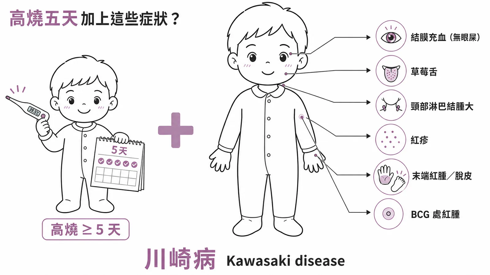 川崎病五大典型症狀與卡介苗處紅腫的全身分布圖