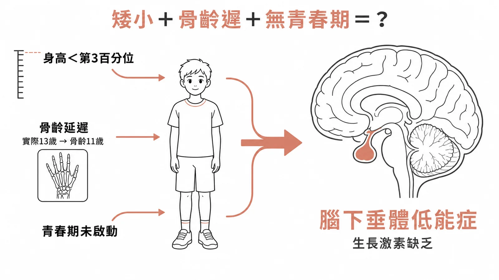 矮小加骨齡延遲加青春期未啟動，指向腦下垂體低能症（生長激素缺乏）