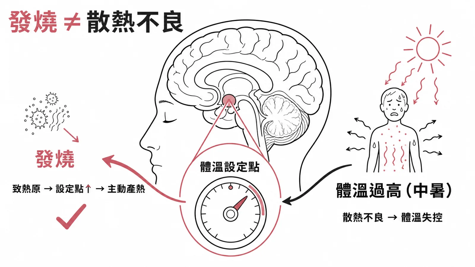 發燒是下視丘設定點升高的主動產熱，不等於散熱不良