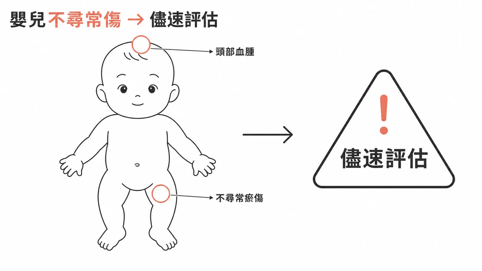 嬰兒不尋常傷處標示：頭部血腫與大腿內側瘀傷需警覺受虐