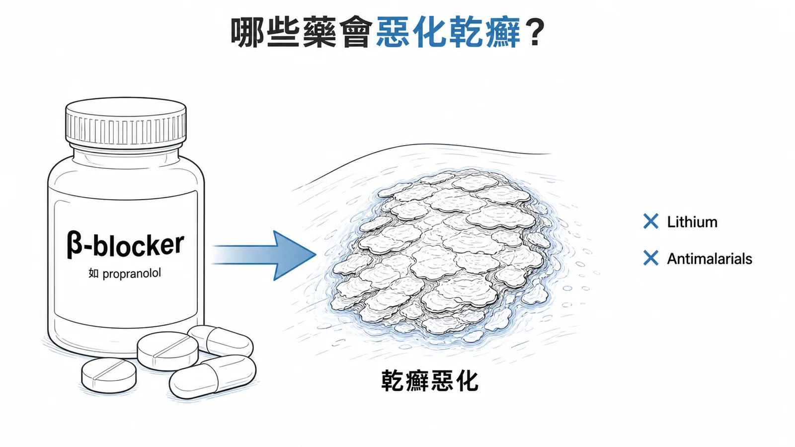 β-blocker等藥物會惡化乾癬的示意圖