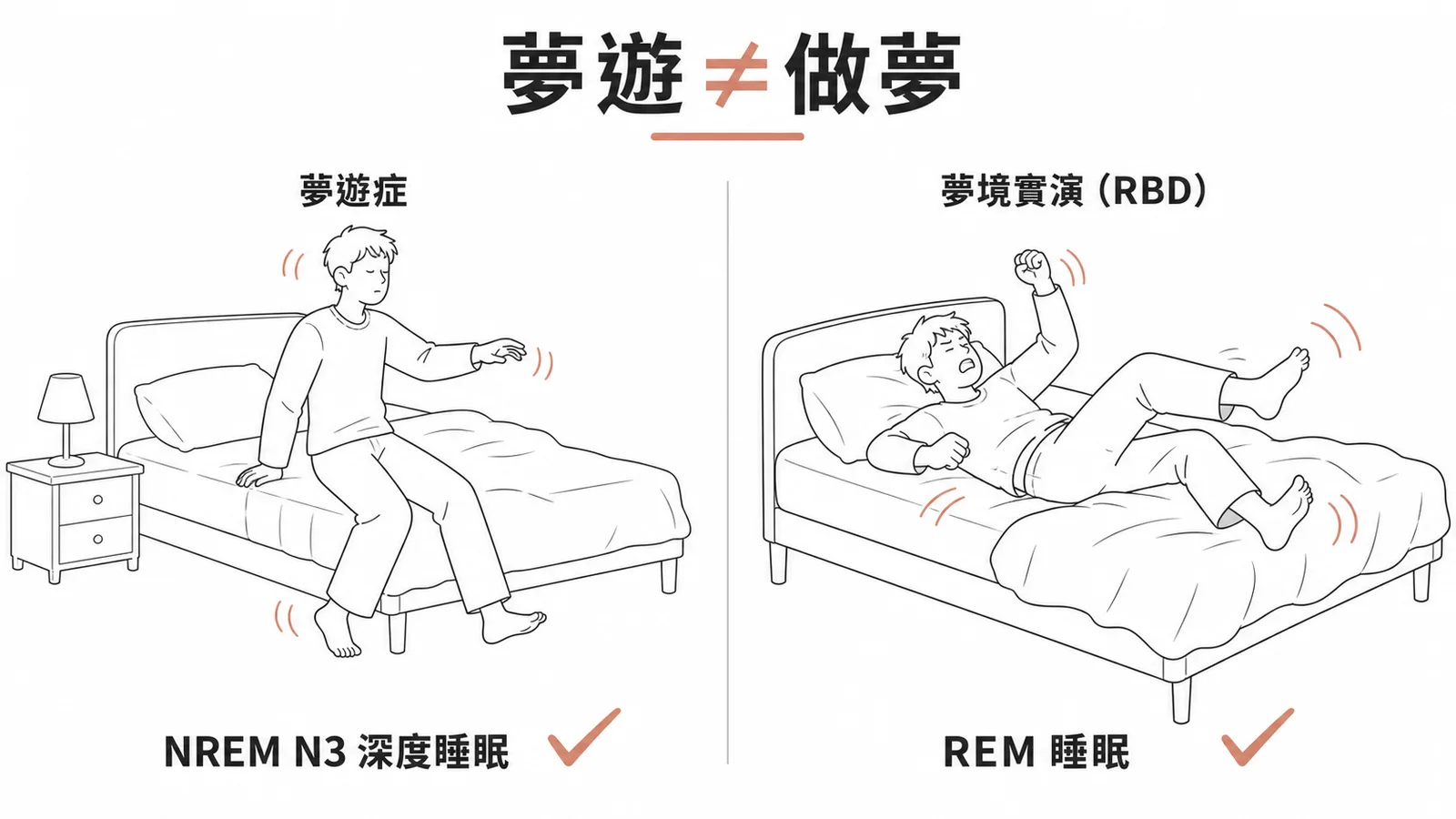 夢遊症發生在 NREM N3 深度睡眠而非做夢，夢境實演才是 REM 睡眠行為障礙