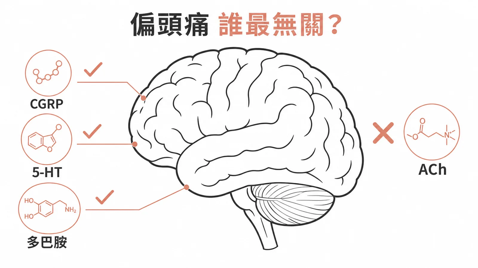 偏頭痛與 CGRP、5-HT、多巴胺高度相關，乙醯膽鹼最不相關