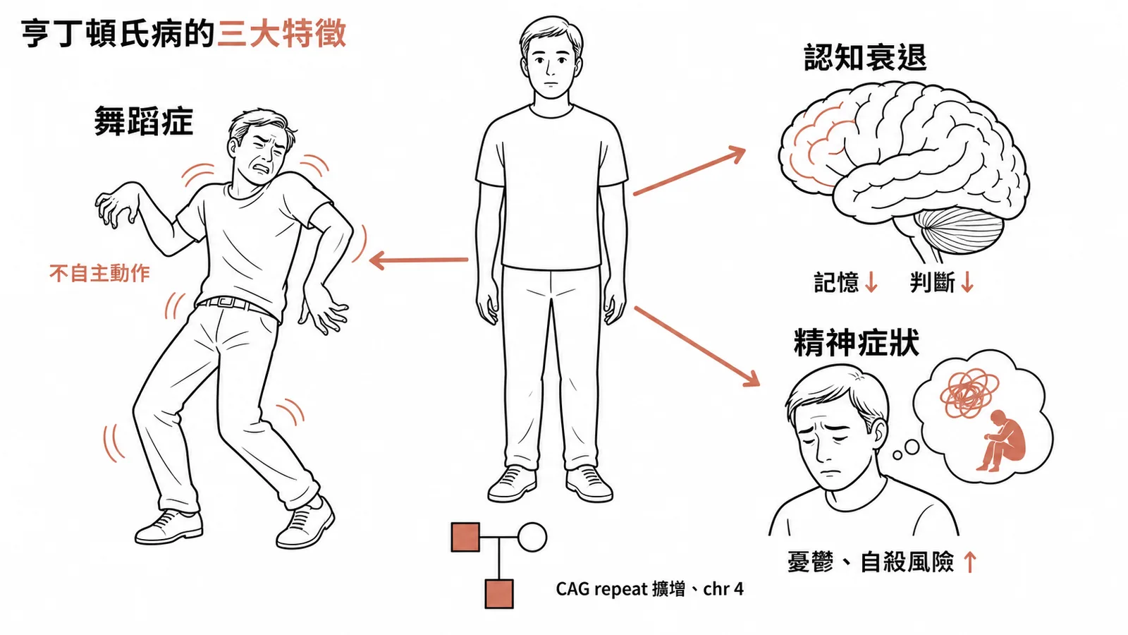 亨丁頓氏病三大特徵：舞蹈症、認知衰退、精神症狀，體染色體顯性遺傳