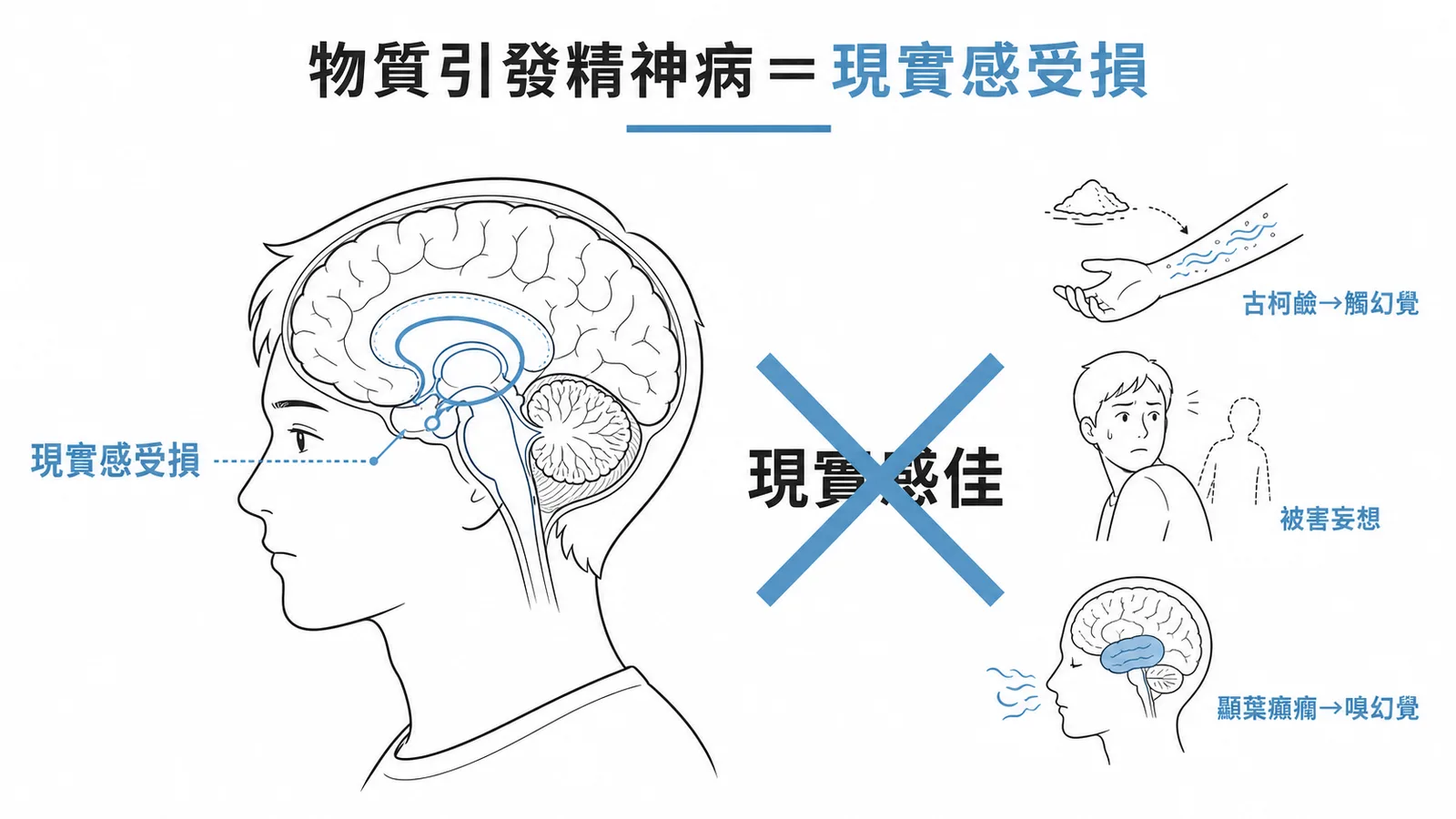 物質引發精神病症時現實感受損示意圖