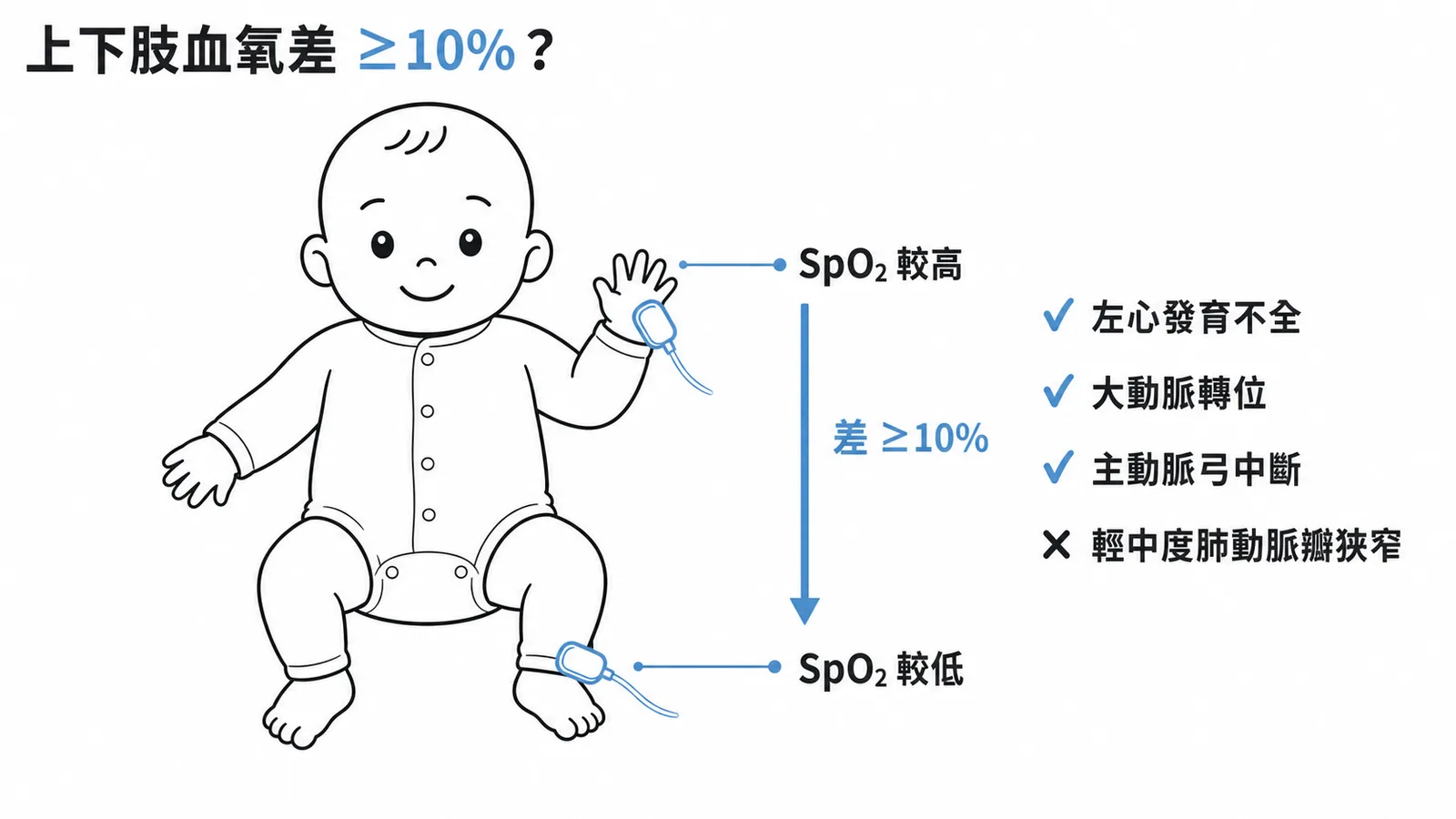 新生兒上下肢血氧差大於10%篩檢發紺型CHD示意圖