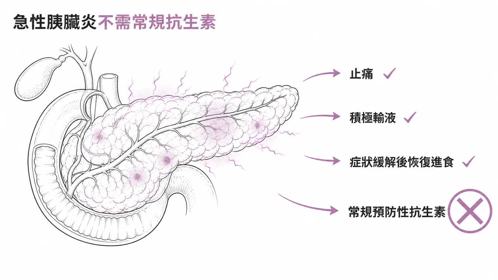 急性胰臟炎不需常規預防性抗生素的處置對照示意圖