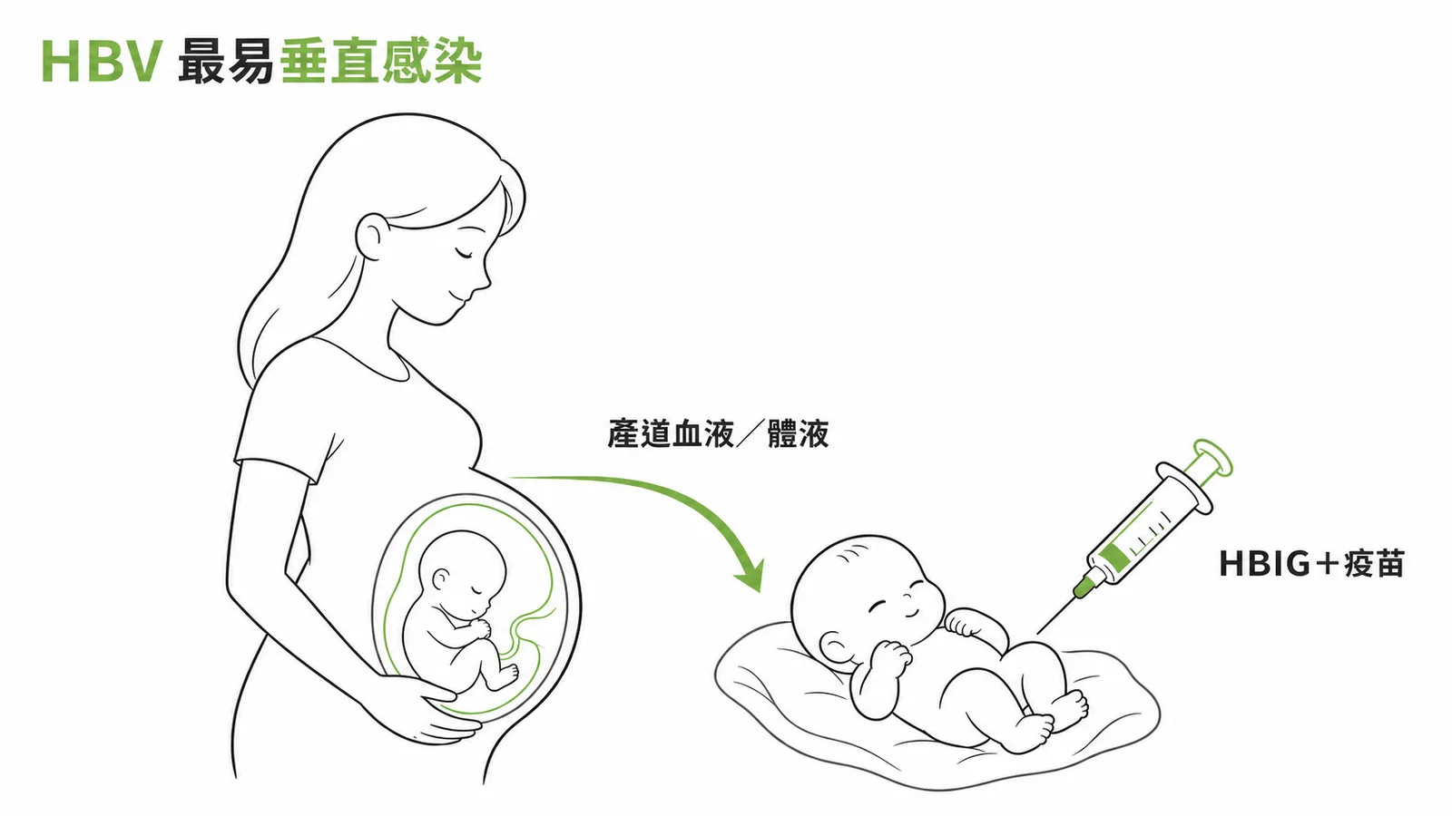 HBV最易經產道垂直感染嬰兒及HBIG疫苗預防示意圖