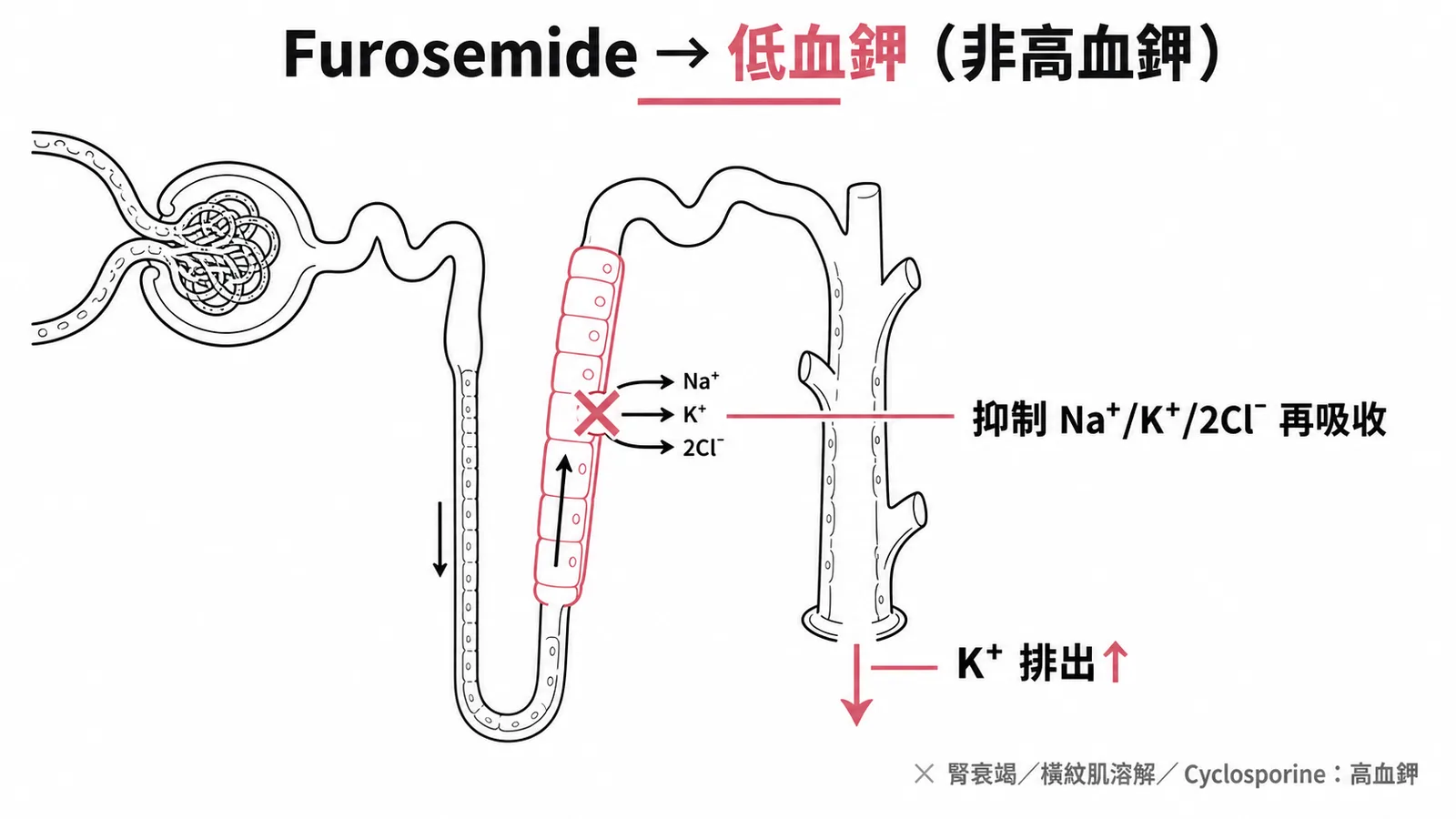 Furosemide 作用於亨利氏環促進鉀離子排出，造成低血鉀而非高血鉀