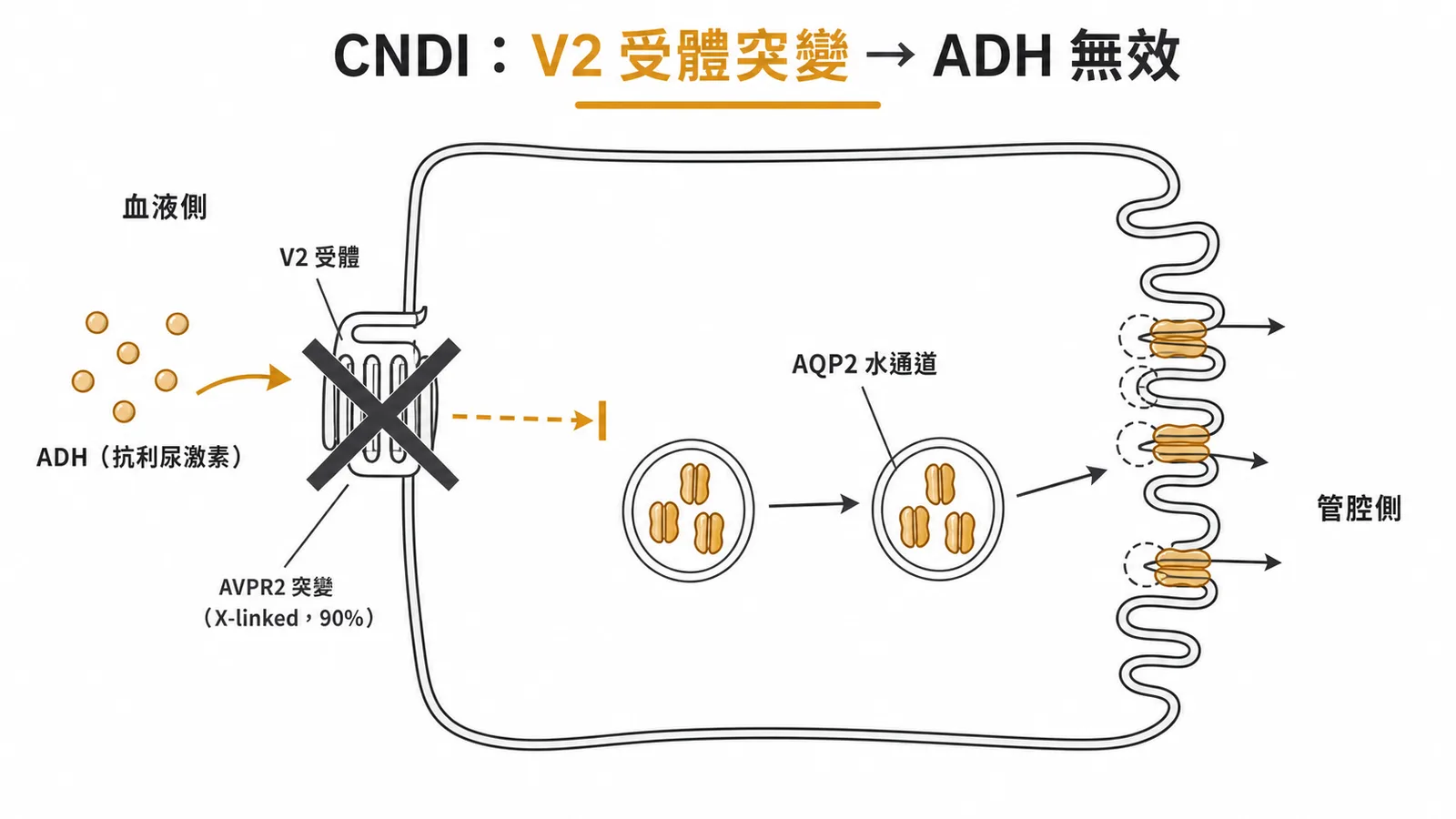 CNDI 集合管上皮細胞中 AVPR2 突變導致 ADH 無法活化 AQP2 水通道