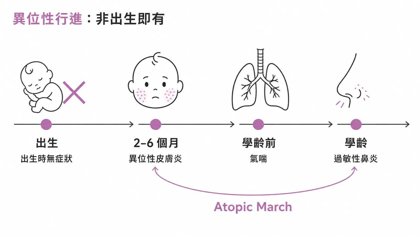 異位性行進時間軸:出生時無症狀、2-6個月起異位性皮膚炎、後續氣喘與過敏性鼻炎