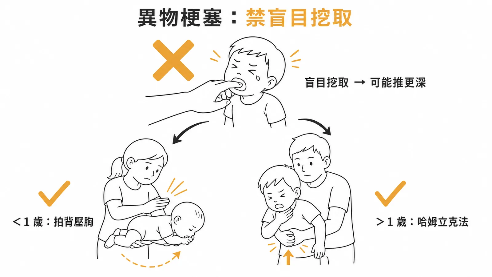 兒童異物梗塞禁盲目挖取及依年齡分急救方式