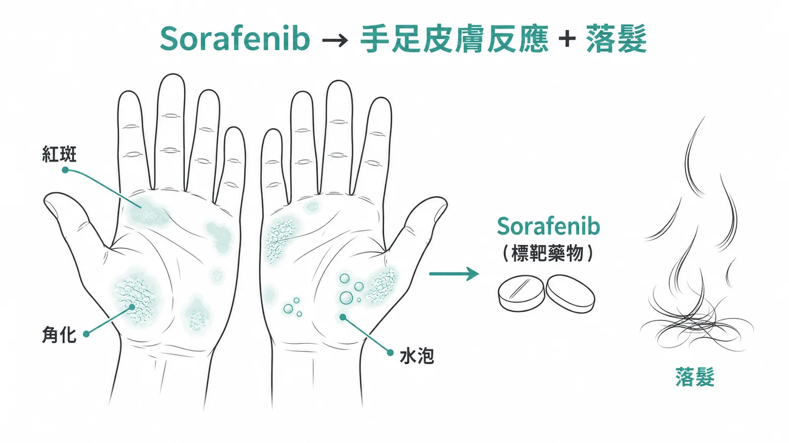 Sorafenib 標靶藥物引起手足皮膚反應與落髮示意圖