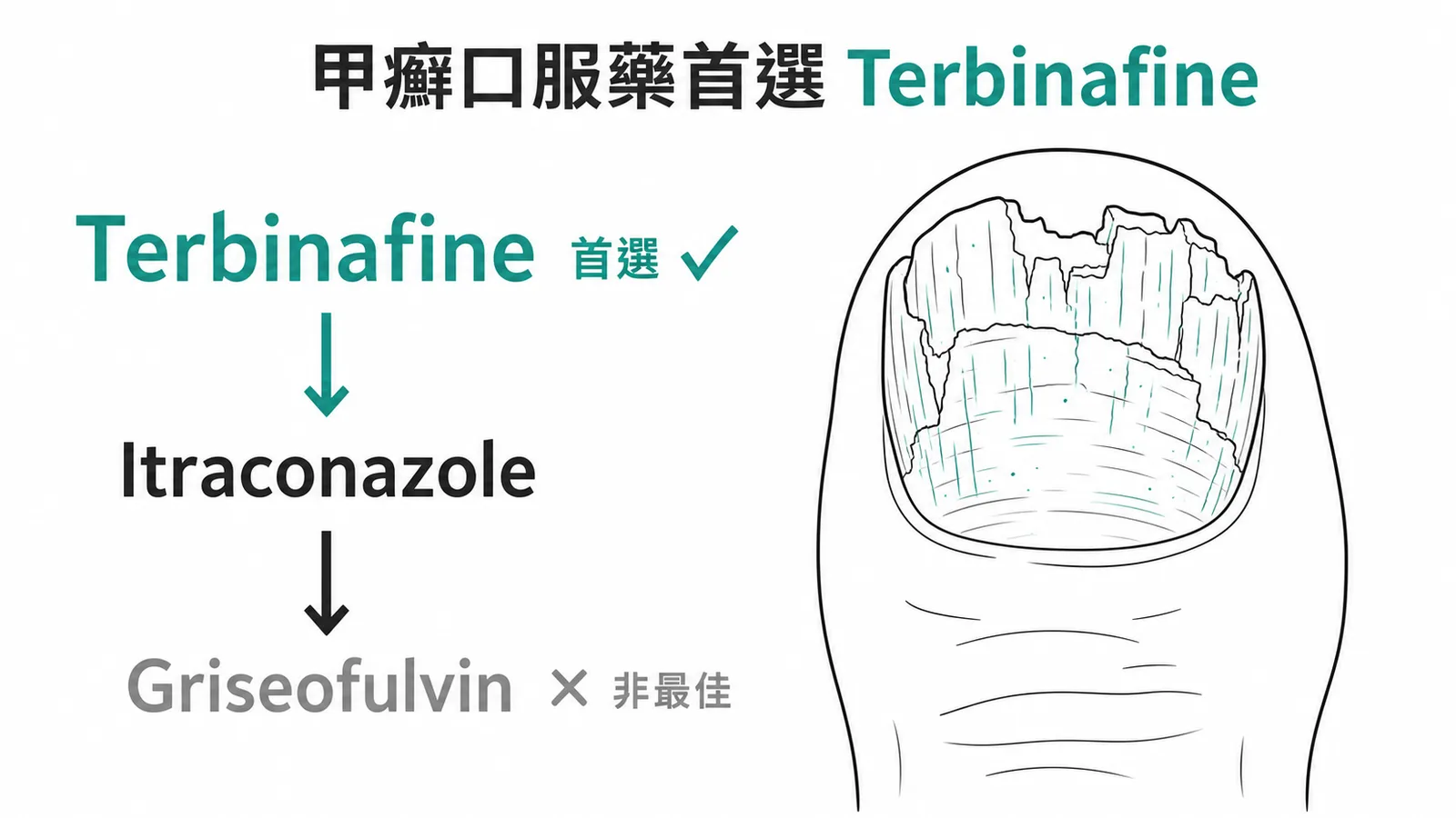 甲癬口服藥首選 Terbinafine 而非 Griseofulvin