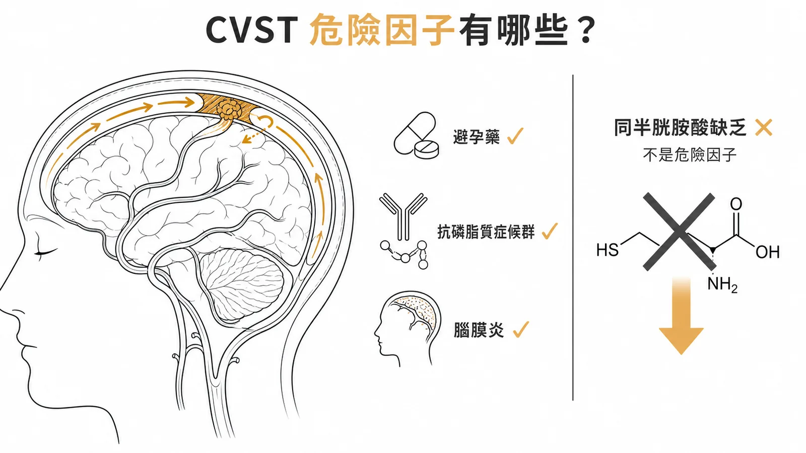 大腦靜脈竇栓塞危險因子示意圖：避孕藥、抗磷脂質症候群、腦膜炎為危險因子，同半胱胺酸缺乏則否