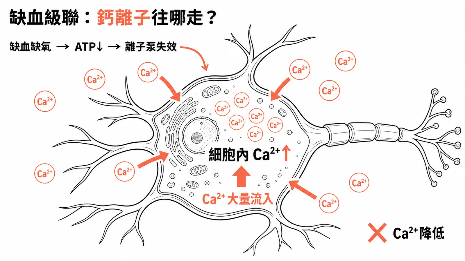缺血級聯反應示意圖：ATP耗竭導致鈣離子泵失效，Ca²⁺大量流入細胞內使濃度升高