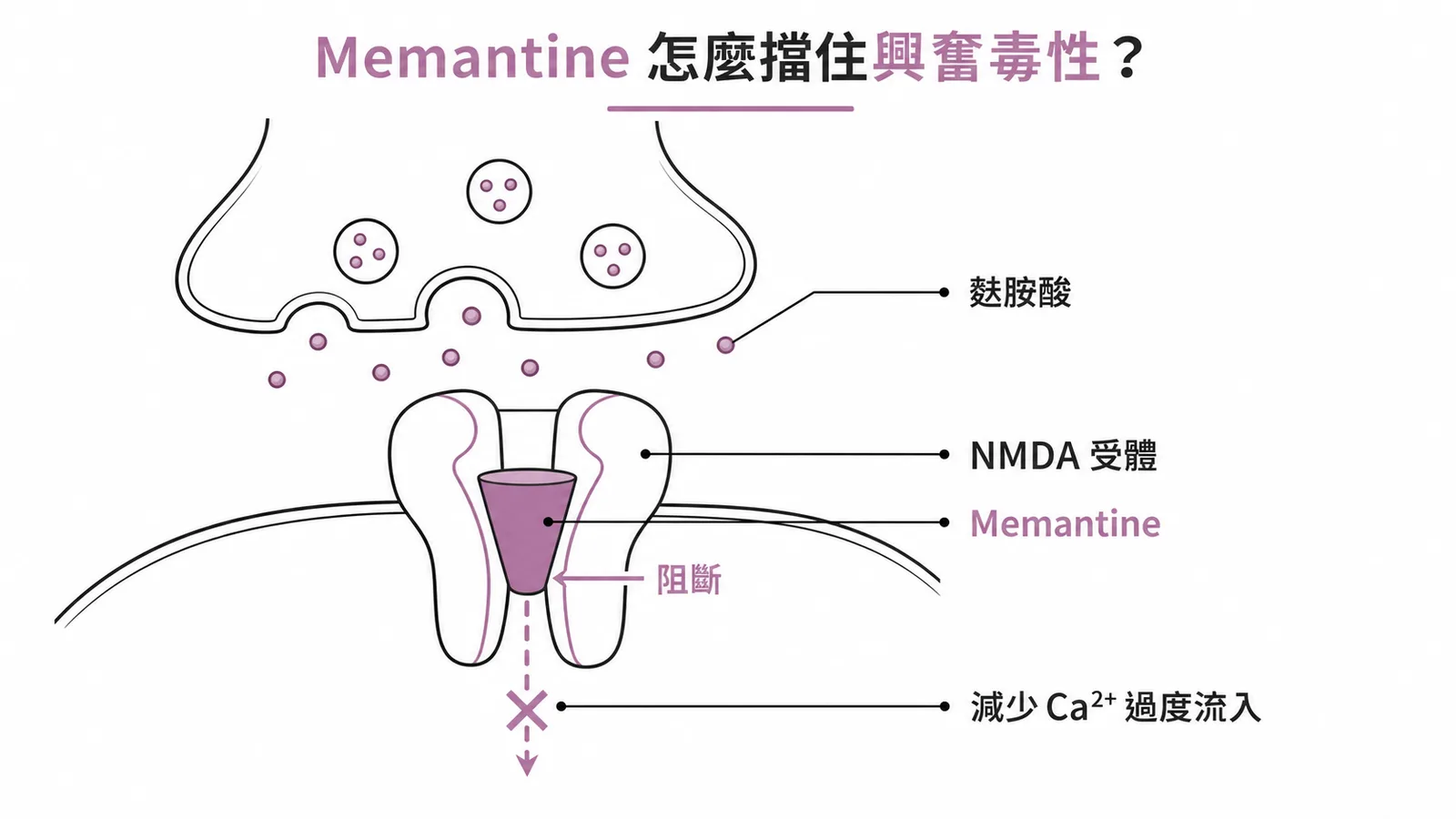 Memantine作用機轉示意圖：阻斷突觸後NMDA受體，減少Ca²⁺過度流入以降低興奮毒性