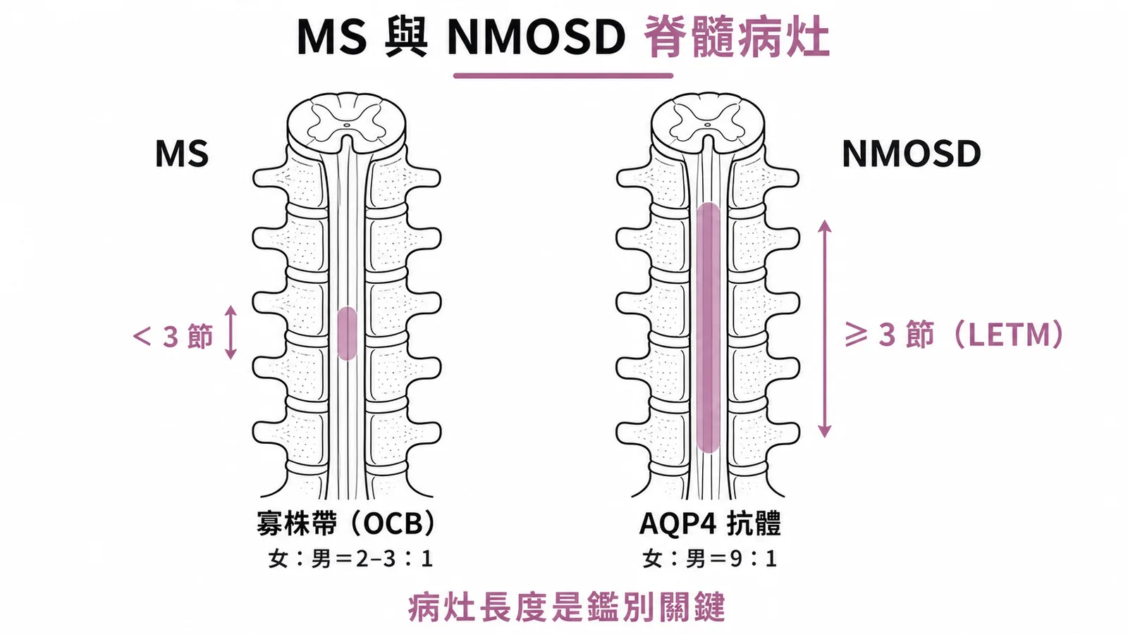 MS與NMOSD脊髓病灶長度差異對比示意圖