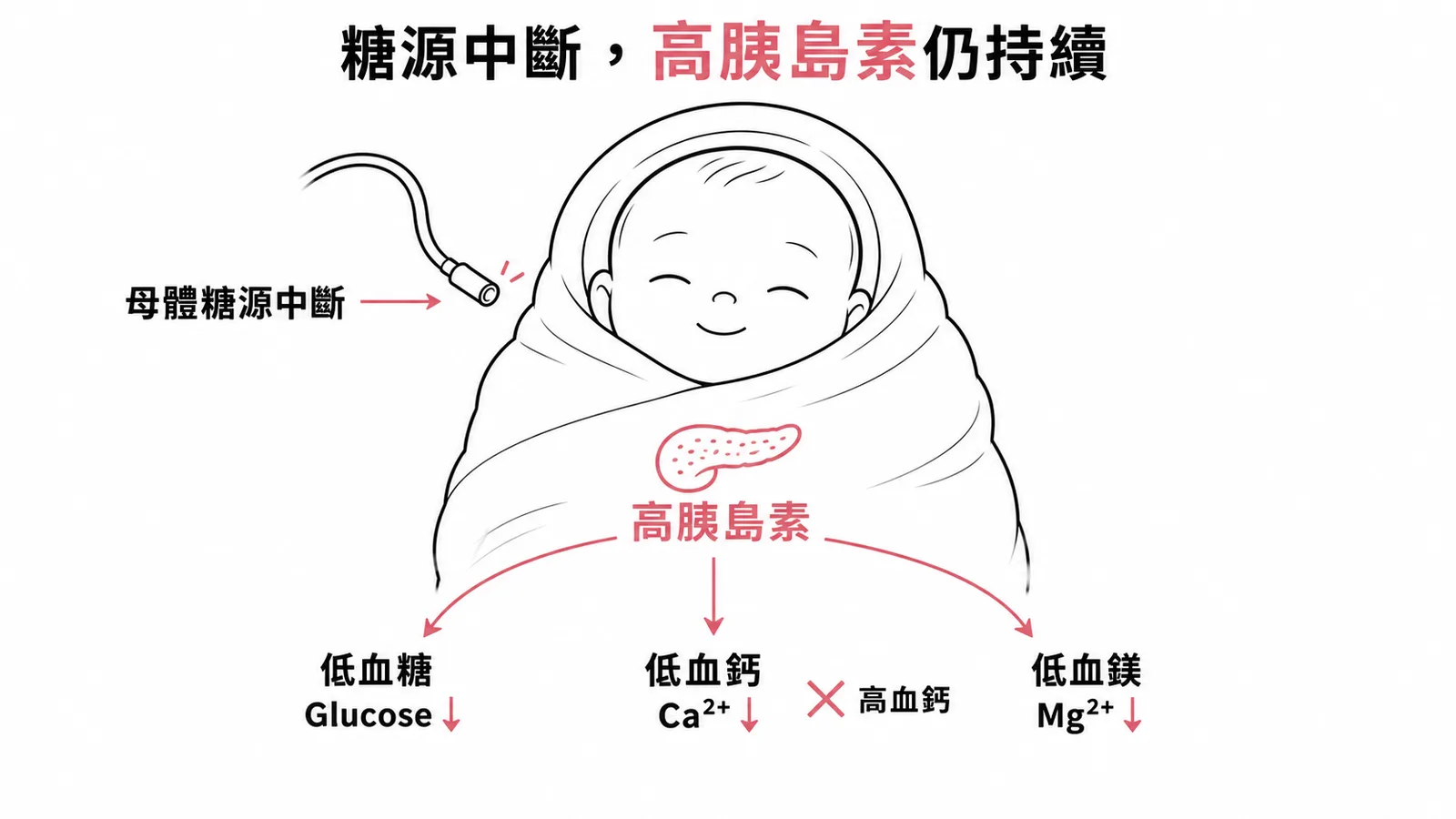 糖尿病母親嬰兒出生後高胰島素導致低血糖低血鈣低血鎂