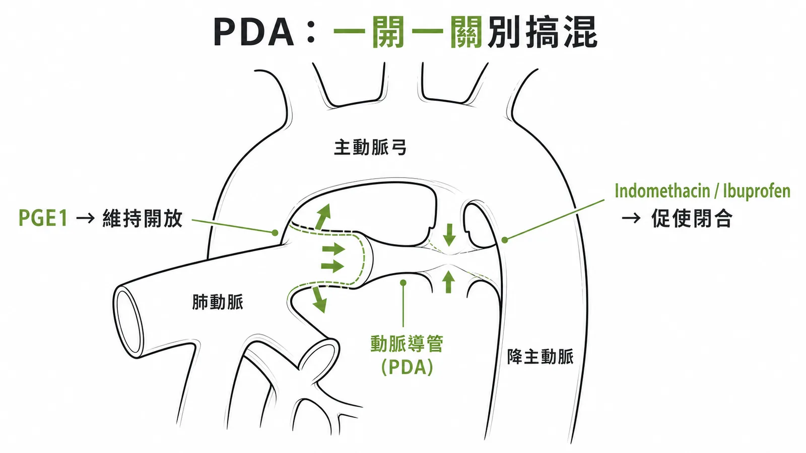 PGE1維持動脈導管開放而Indomethacin促使閉合的對比