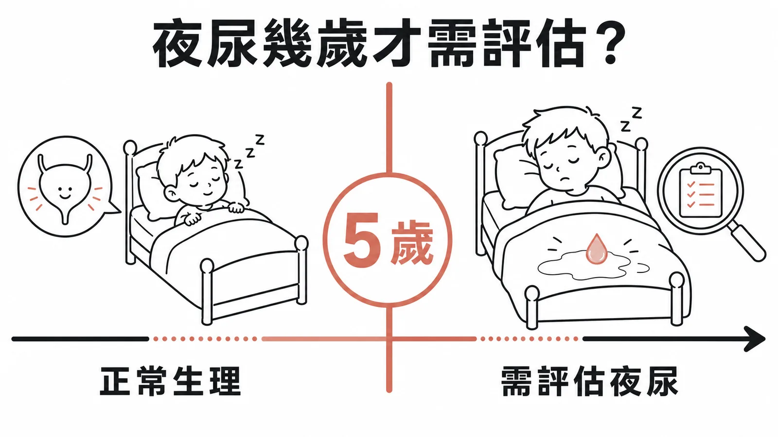 兒童夜尿診斷以5歲為分界，5歲以下屬正常生理