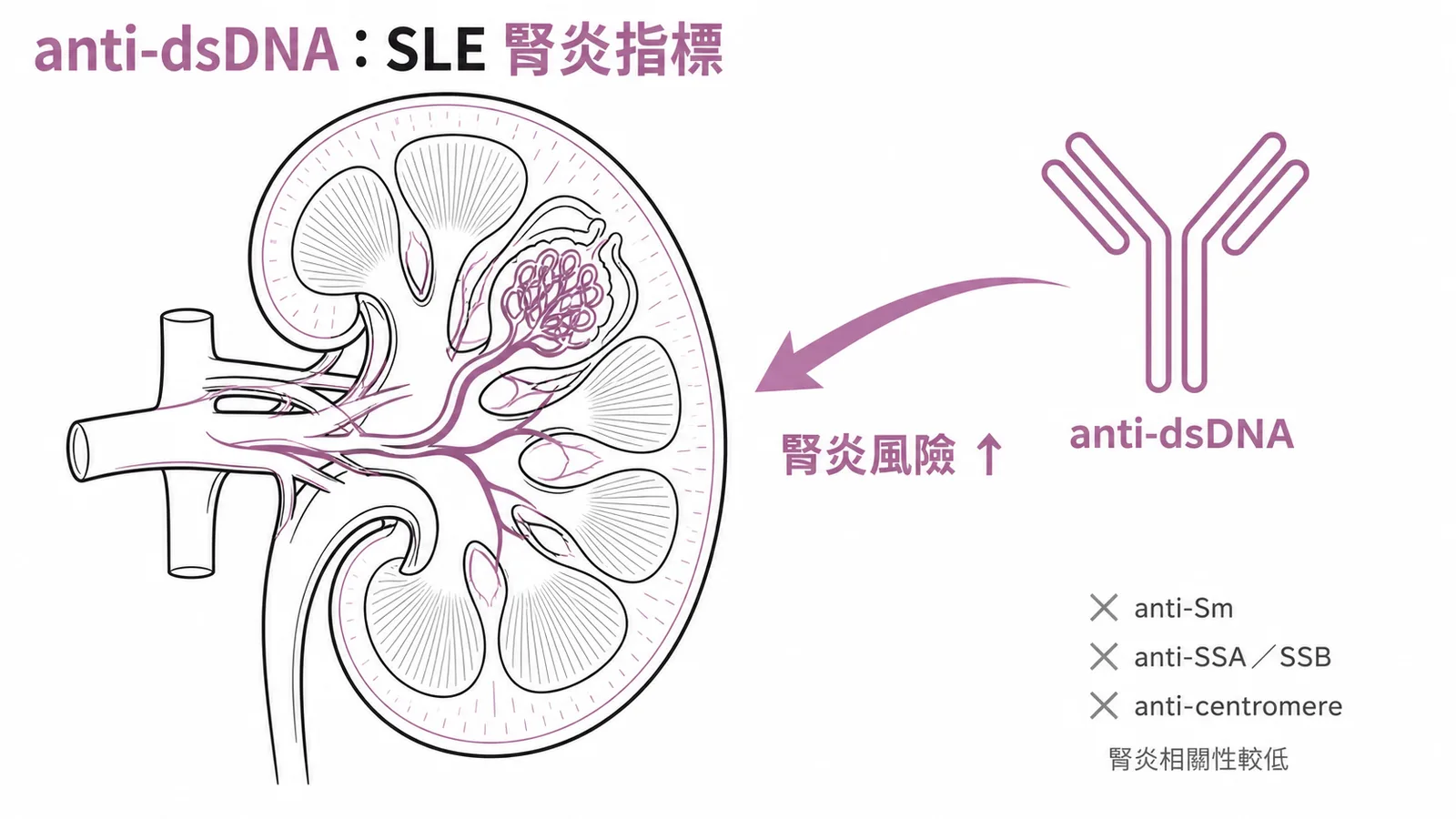 anti-dsDNA抗體是SLE特異性指標，效價與狼瘡性腎炎高度相關
