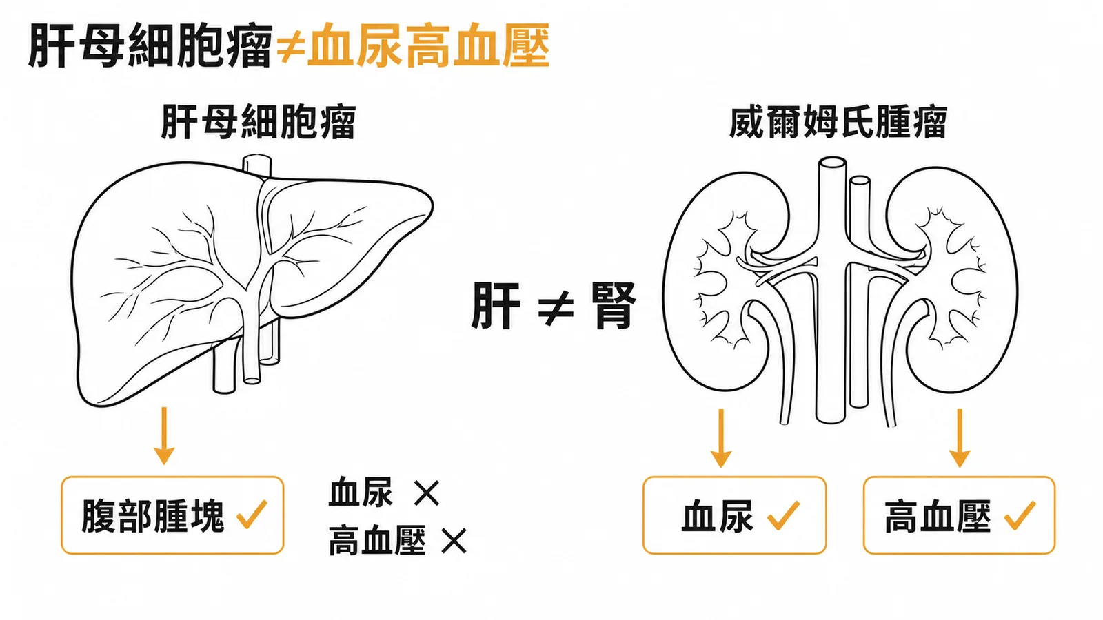 肝母細胞瘤以腹部腫塊為主，血尿高血壓屬Wilms tumor特徵