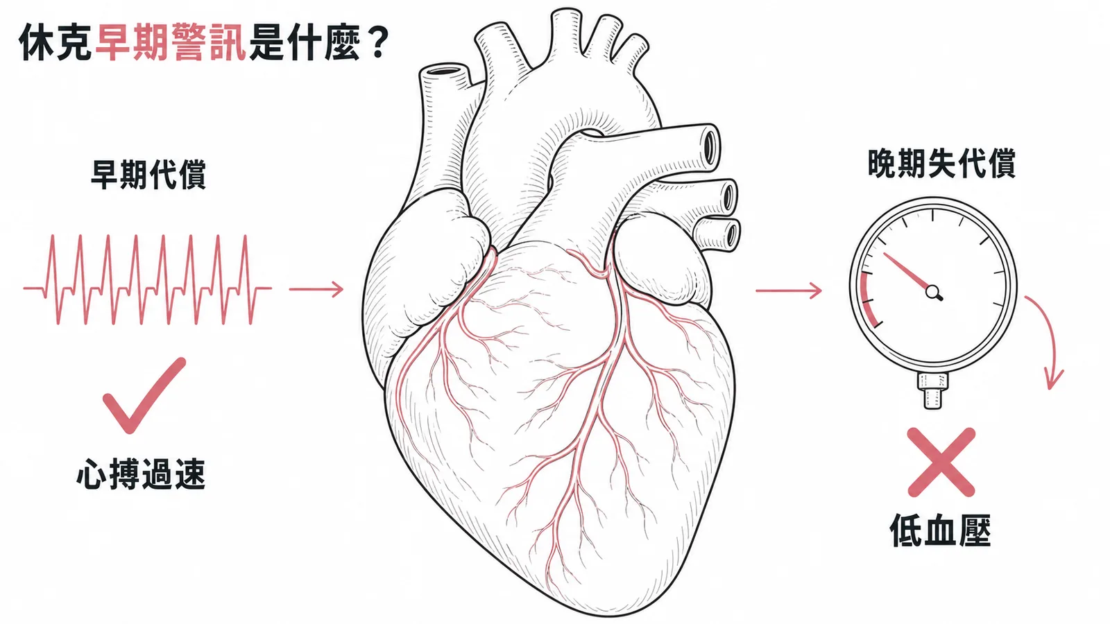 休克早期代償心搏過速與晚期低血壓對比示意圖