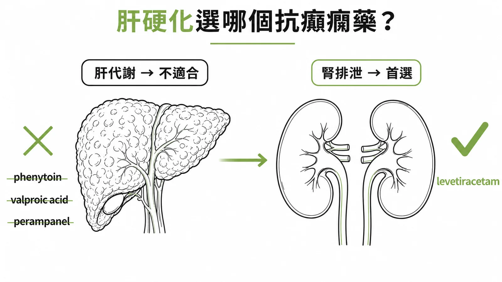 肝硬化選抗癲癇藥：肝代謝藥不適合而levetiracetam經腎排泄為首選