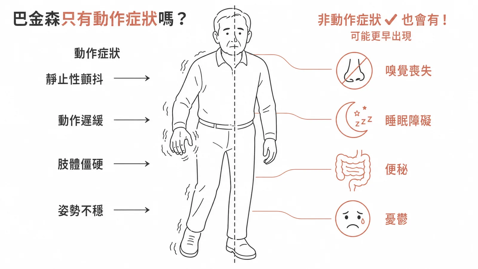 巴金森氏病動作與非動作症狀對照:非動作症狀可能更早出現