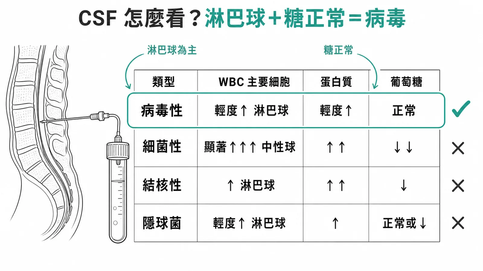 CSF鑑別腦膜炎:淋巴球為主+葡萄糖正常=病毒性腦膜炎