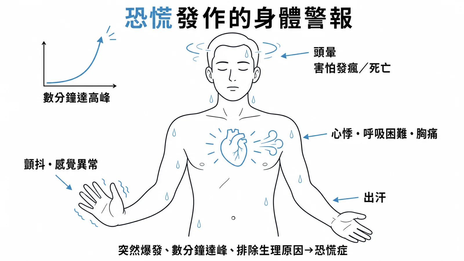 恐慌發作的身體症狀群：頭暈、心悸、呼吸困難、胸痛、顫抖、出汗，數分鐘內達高峰
