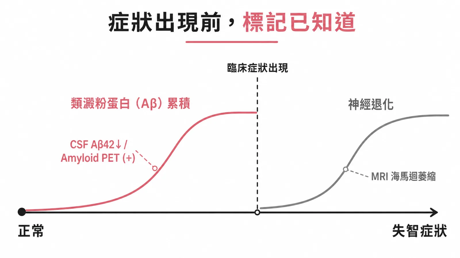 阿茲海默症生物標記時序:類澱粉蛋白標記在臨床症狀出現前已可偵測異常