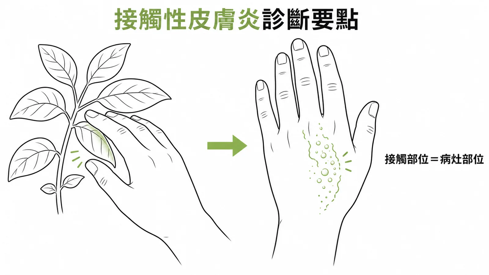 接觸性皮膚炎:手碰觸植物後同部位出現紅疹與小水泡