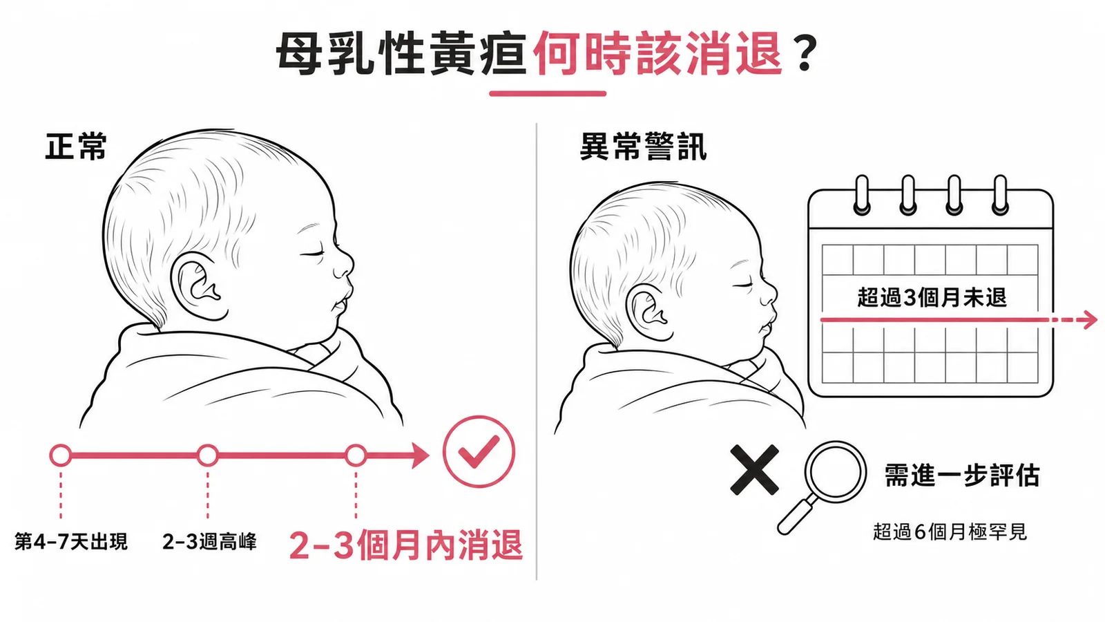 母乳性黃疸消退時間軸：正常2-3個月內消退，超過3個月需進一步評估