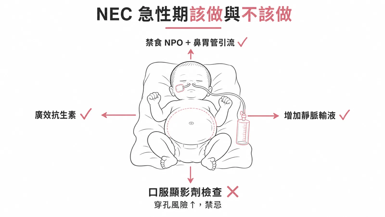 早產兒壞死性腸炎NEC急性期處置：禁食、抗生素、輸液為正確處置，口服顯影劑為禁忌