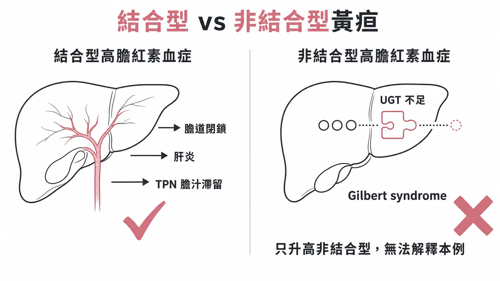 結合型vs非結合型黃疸：Gilbert syndrome只產生非結合型高膽紅素血症，無法解釋結合型膽紅素升高