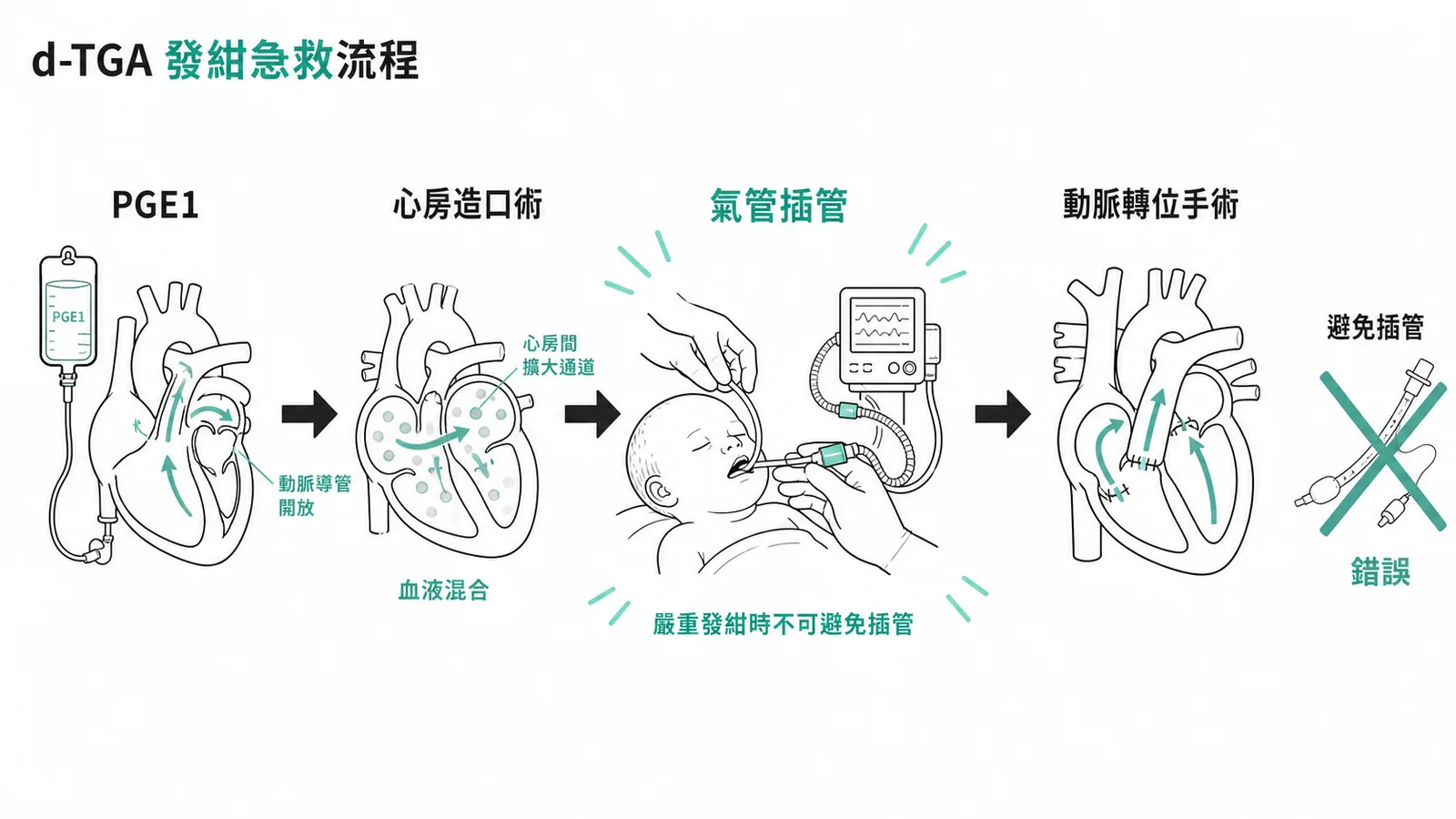 d-TGA 發紺急救流程：PGE1、心房造口術、氣管插管、動脈轉位手術