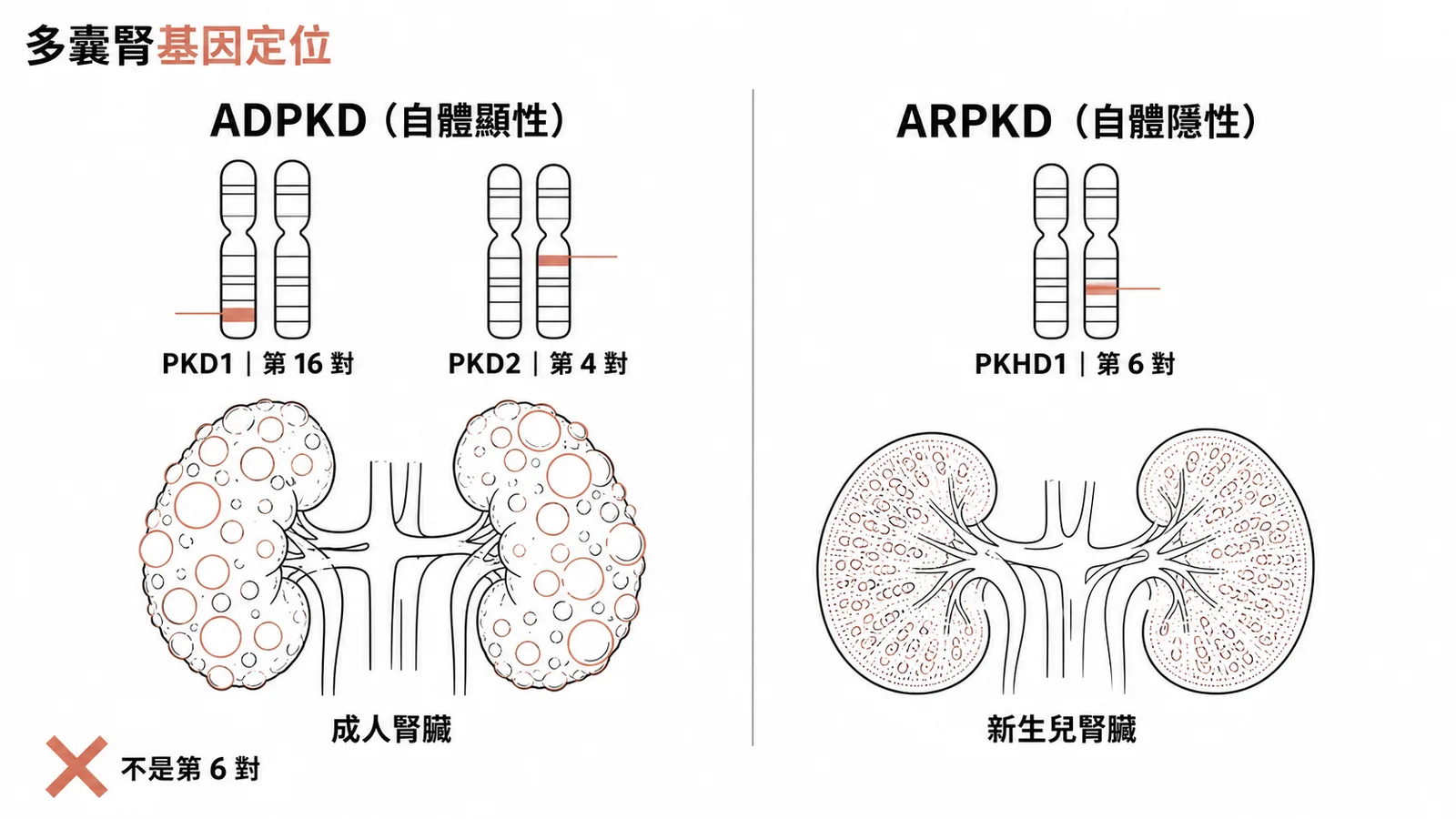 多囊腎基因定位：ADPKD 在第 16 和第 4 對染色體，ARPKD 在第 6 對