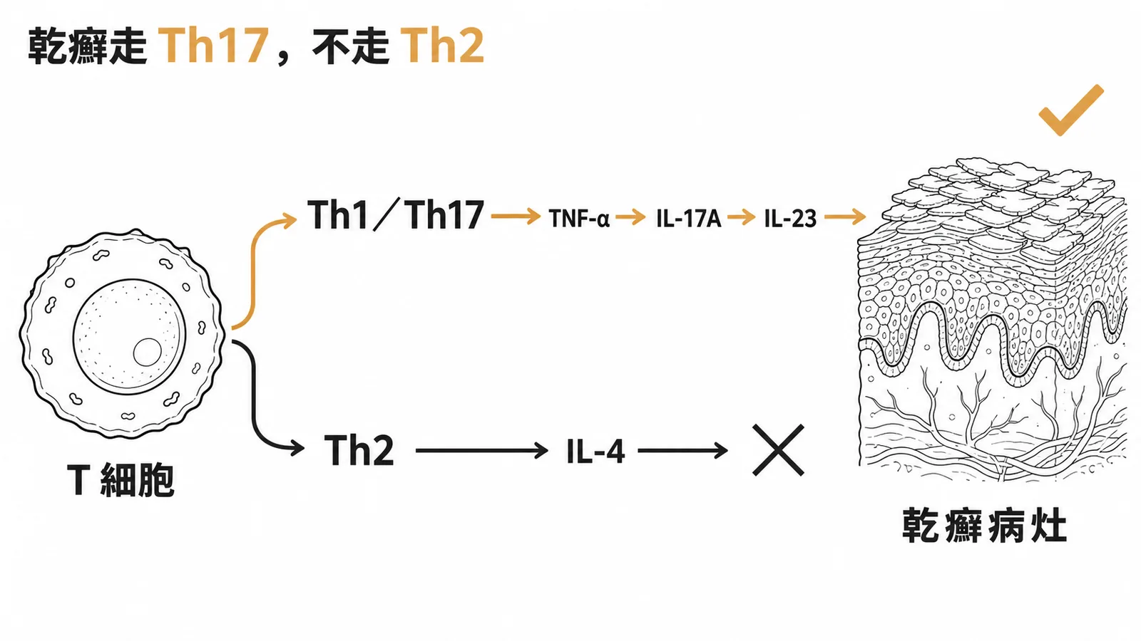 乾癬免疫路徑:Th1/Th17 的 TNF-α、IL-17A、IL-23 為有效標靶,Th2 的 IL-4 無效