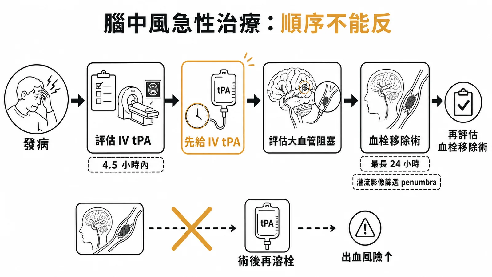 急性缺血性腦中風治療順序:先IV tPA再評估血栓移除術,術後再溶栓會增加出血風險